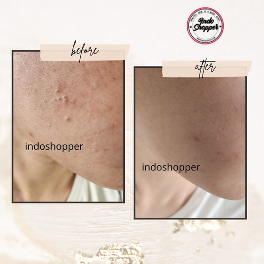 Review Paula's Choice Skin Perfecting 2% BHA Liquid