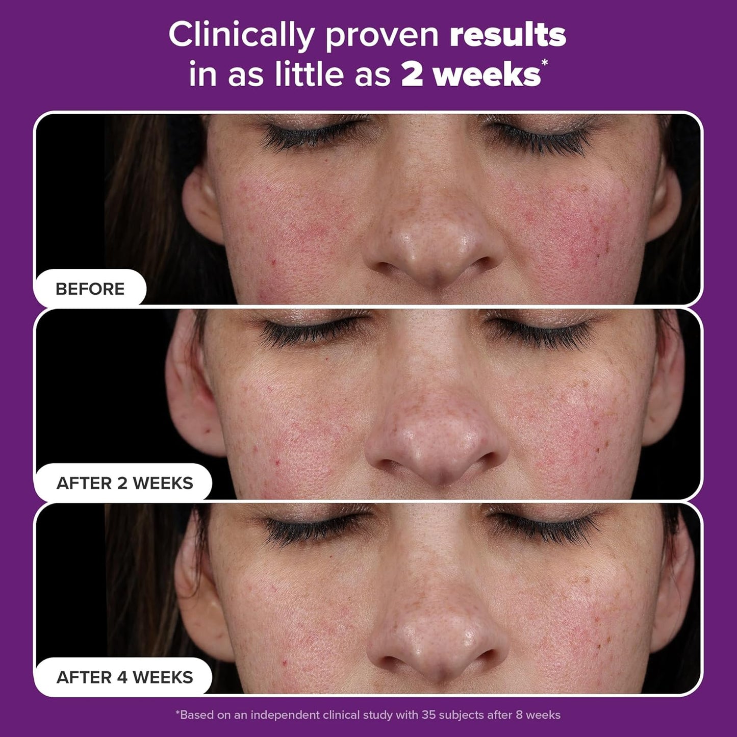 New- CLINICAL PRO Retinaldehyde Dual-Retinoid Treatment - Paula's Choice