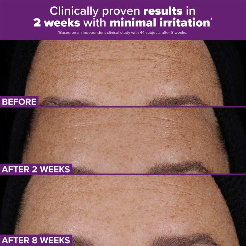 New- CLINICAL PRO Retinaldehyde Dual-Retinoid Treatment - Paula's Choice